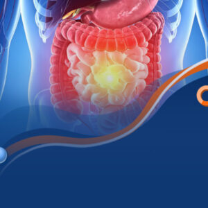 [PRESENCIAL] Imersão em Doenças inflamatórias intestinais
